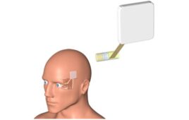 Concept illustration of the electrode technology to restore a person's optic nerve function after an eye transplant. Credit- Jungho Yi of the Dayeh’s lab at UC San Diego (1) (1)