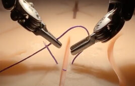 A screengrab of a video demonstrating a surgical robot learning tasks.