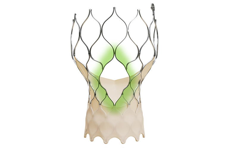Tavr Material The top nitinol cardiac medtech news of 2025 (so far)