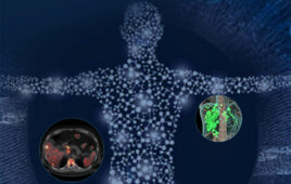 An illustration depicting theranostics, which is the use of one radioactive drug to diagnose and a second radioactive drug for treatment, both targeting the same cancer cell receptor.