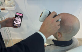 A wireless ultrasound device imaging a patient's brain through a sonolucent cranial implant.
