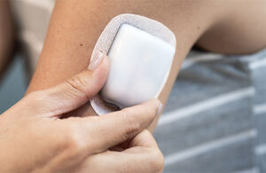 A photo of an Insulet Omnipod 5 automated insulin delivery patch worn on the back of a woman's arm.