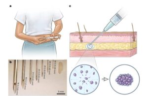 MIT long-lasting delivery of drugs