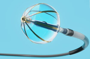 An image of the The Abbott Volt pulsed field ablation (PFA) catheter.
