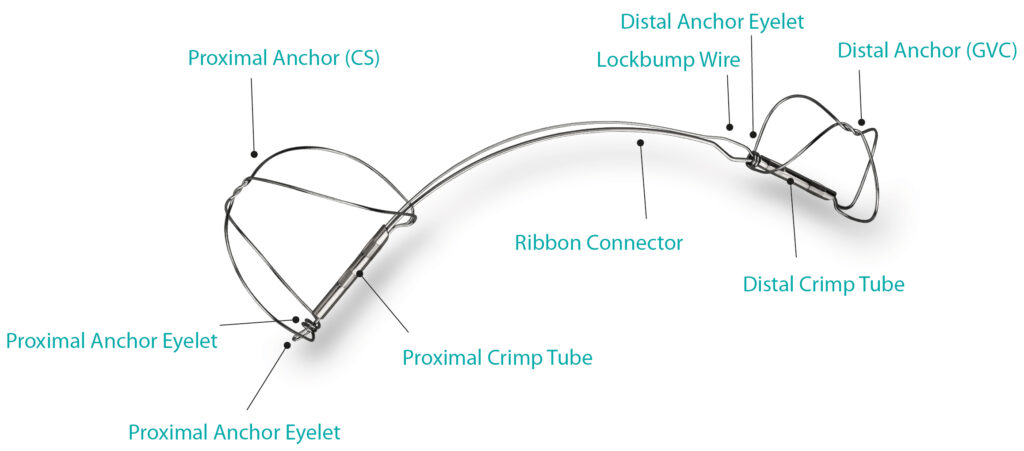 A photo showing the different components of the Cardiac Dimensions Carillon Mitral Contour System implant.