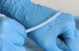 A photo of a Foley catheter with lubricant.