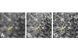 NIH AI Comparison of the same patch of retina labeled with indocyanine green and visualized three different ways (1)