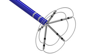 An image of the Pulse Biosciences CellFX nsPFA 360° catheter.