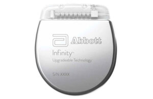 A phot of Abbott's Infinity deep brain stimulation (DBS) neurostimulator.