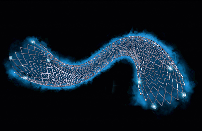 This is a Boston Scientific illustration of its Eluvia drug-eluting stent for treating peripheral artery disease or PAD.