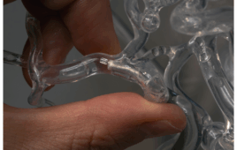 Close-up view of a transparent vascular model held by fingers, showcasing the milli-spinner device — a tiny, hollow rotating tube with fins and slits designed to generate localized suction for shrinking blood clots without rupturing them.
