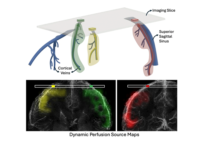 UC Berkeley MRI