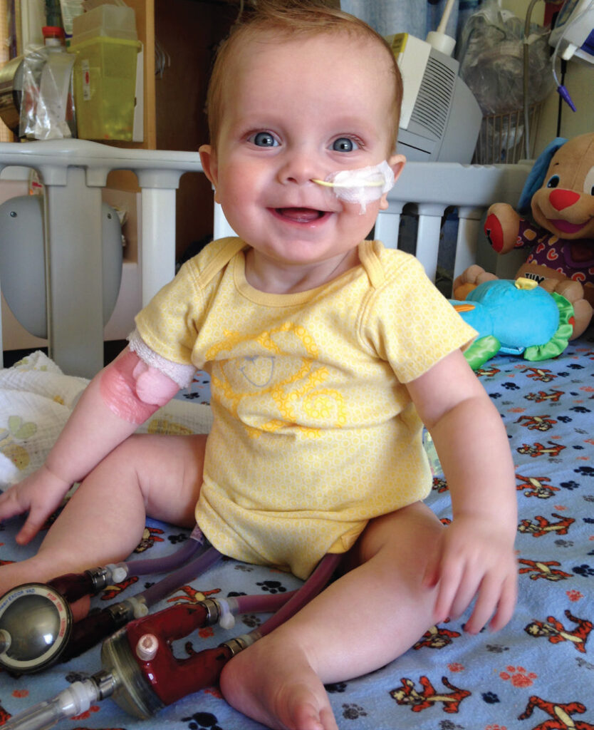A photo of a baby on a Berlin Heart EXCOR pediatric ventricular assist device (VAD).