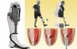 Illustration of MIT’s bone-anchored bionic knee: powered prosthetic leg, amputee using the device to walk and step over an obstacle, and cross-sections of thigh muscles showing electrodes and a titanium implant connecting nerves and bone.