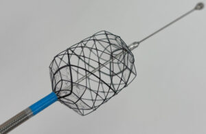 A photo of an Aqua Medical radiofrequency vapor ablation catheter