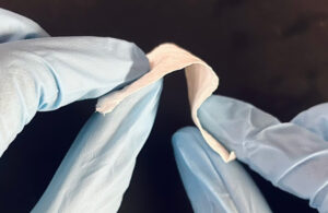 A photo of NatureFound Biotech's ChitoSeal product.