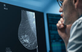 A photo of a GE HealthCare Pristina Recon DL mammography image.