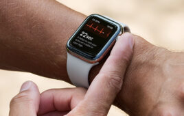 A photo of the Apple Apple Watch ECG app.