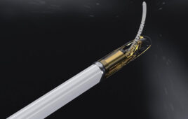 A photo of the Francis Medical Vanquish Water Vapor Ablation device.