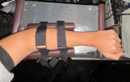A photo of MIT's noninvasive glucose monitor device.