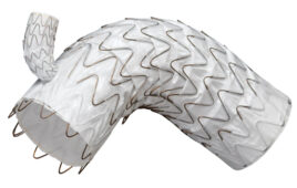A photo of Gore Medical's Tag thoracic branch endoprosthesis (TBE).