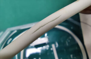A photo of a ruptured Erbe cryoprobe.