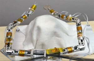 A prototype of Vicarious Surgical's robotic system holding a dime.