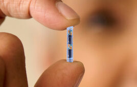 Senseonics Eversense 365 CGM implant fingers