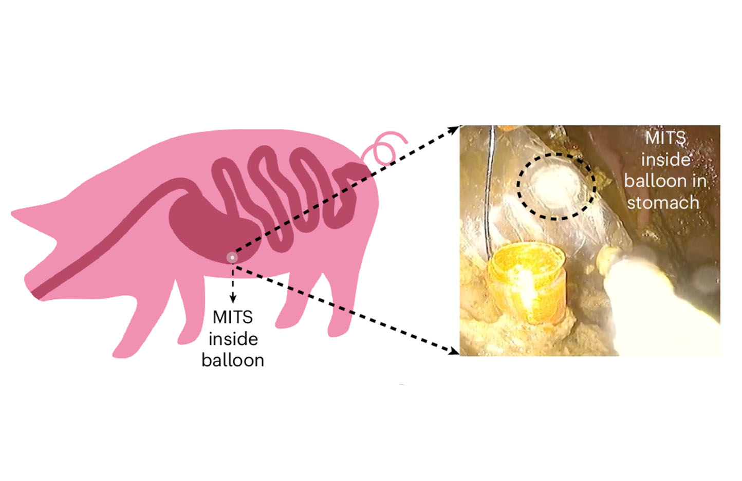 An image of MITS inside of a pig.
