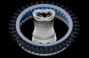 An illustration of Midjourney's ultrasonic CT prototype.