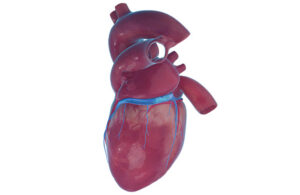 A illustration of VahatiCor's A-Flux implant in the coronary sinus.