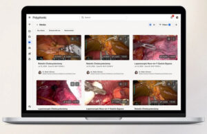An image of J&J's Polyphonic digital ecosystem displaying surgical data from Ottava.