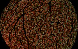 Feinstein Institutes' research on the vagus nerve under a microscope.