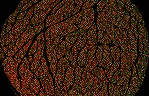 Feinstein Institutes' research on the vagus nerve under a microscope.