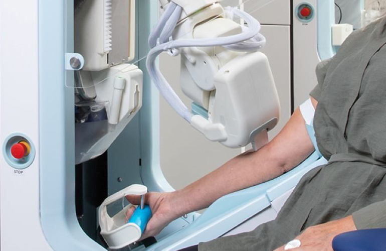 A patient's arm undergoing a blood draw by Vitestro's Aletta device.