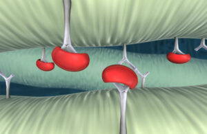 An illustration of Edwards Lifesciences' proprietary stable-capping technology.