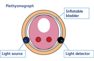 An illustration depicting how BD's finger cuff uses a plethysmograph sensor to noninvasively monitor blood pressure.