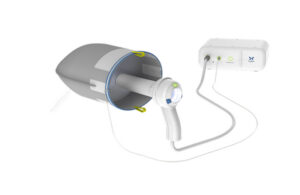An image of Claria's system for minimally invasive hysterectomies.