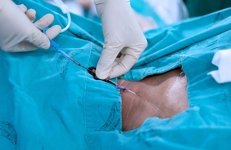 A clinician guides a needle and wire into the side of a patient's neck during a central venous catheter insertion.