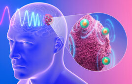 MIT researchers developed injectable nanodevices that remotely kill brain tumor cells