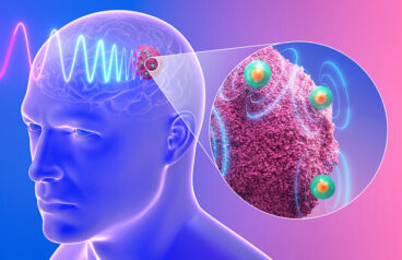 An illustration of HITMAN operating in glioblastoma cells.