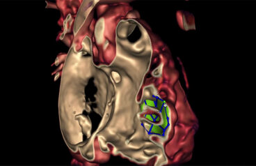 An image showing a three-dimensional (3D) model of a heart.