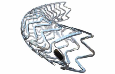 An image of the Teleflex Freesolve RMS resorbable magnesium scaffold.